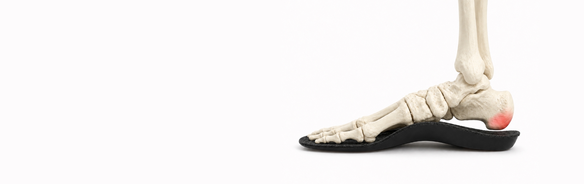 Heel-relief-usp